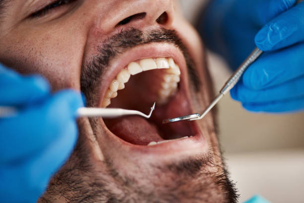 Best Emergency Gum Pain Relief  in Churchill, OH